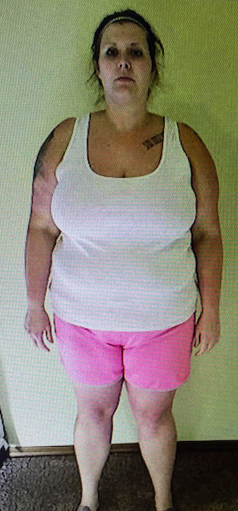 Before Pic - not great quality Before Pic - not great quality